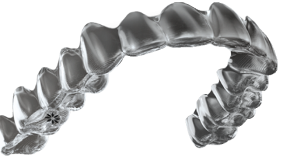 nvisalign Orthodontic Treatment by Dr. Inglezos.