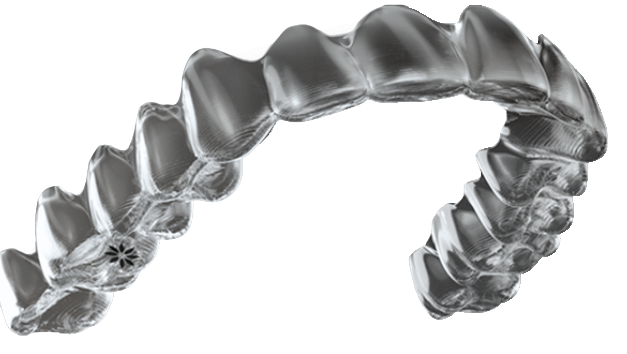 nvisalign Orthodontic Treatment by Dr. Inglezos.