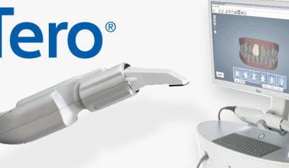 3D image of your teeth in just minutes using an iTero intraoral scanner.