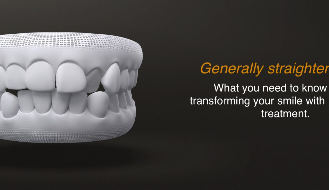 General Teeth Straighten with Invisalign